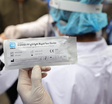 As&iacute; realizan tamizajes para disminuir riesgo de contagio por COVID-19 en Santa Elena