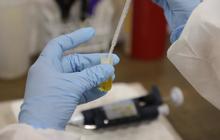 Avanza estudio de Ivermectina en pacientes con covid-19