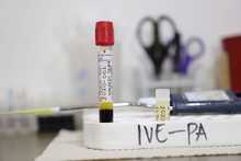 Avanza estudio de Ivermectina en pacientes con covid-19