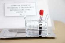 Avanza estudio de Ivermectina en pacientes con covid-19