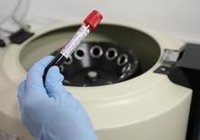 Avanza estudio de Ivermectina en pacientes con covid-19