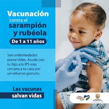 El s&aacute;bado, jornada de vacunaci&oacute;n contra sarampi&oacute;n-rub&eacute;ola y esquema regular