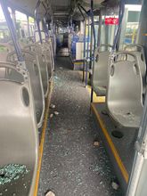 &ldquo;Vandalismo contra el MIO es un ataque a los cale&ntilde;os&rdquo;, conductor del masivo en grave riesgo de perder un ojo