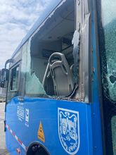 &ldquo;Vandalismo contra el MIO es un ataque a los cale&ntilde;os&rdquo;, conductor del masivo en grave riesgo de perder un ojo