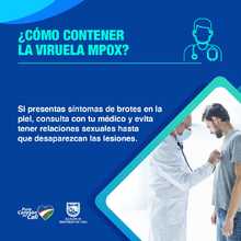 Cali completa dos semanas sin casos de viruela s&iacute;mica