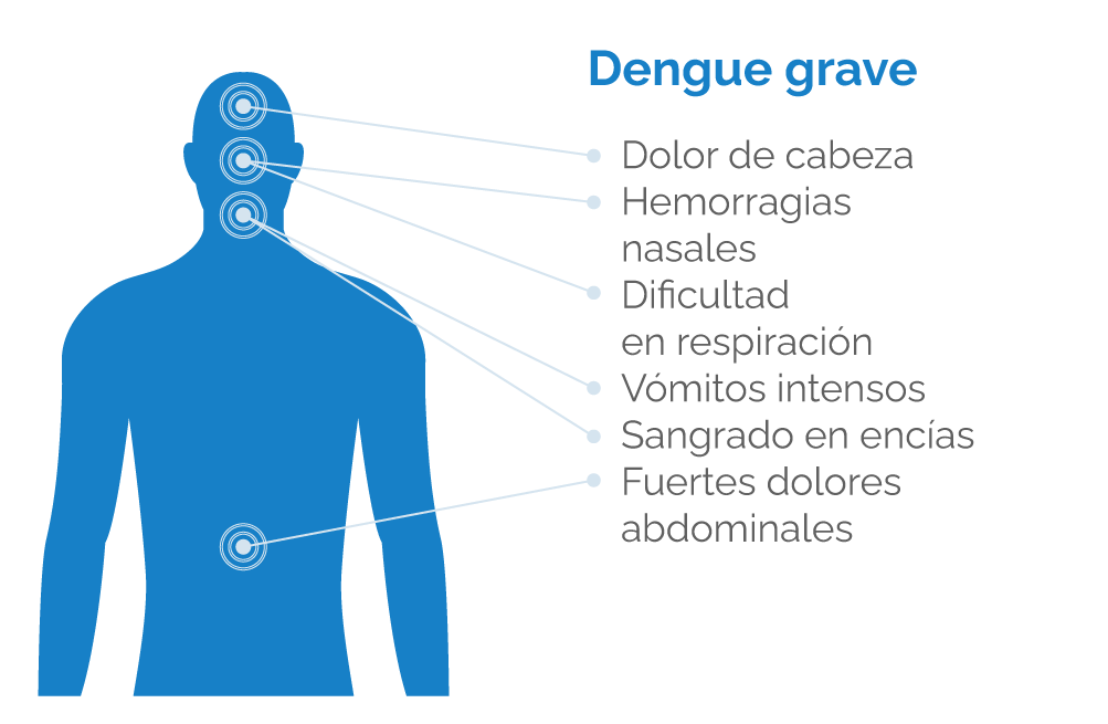 Dengue Grave